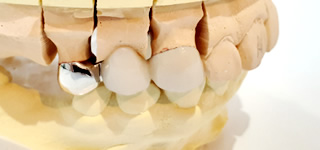 ブリッジの写真