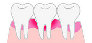 口唇裂傷の写真・イラスト